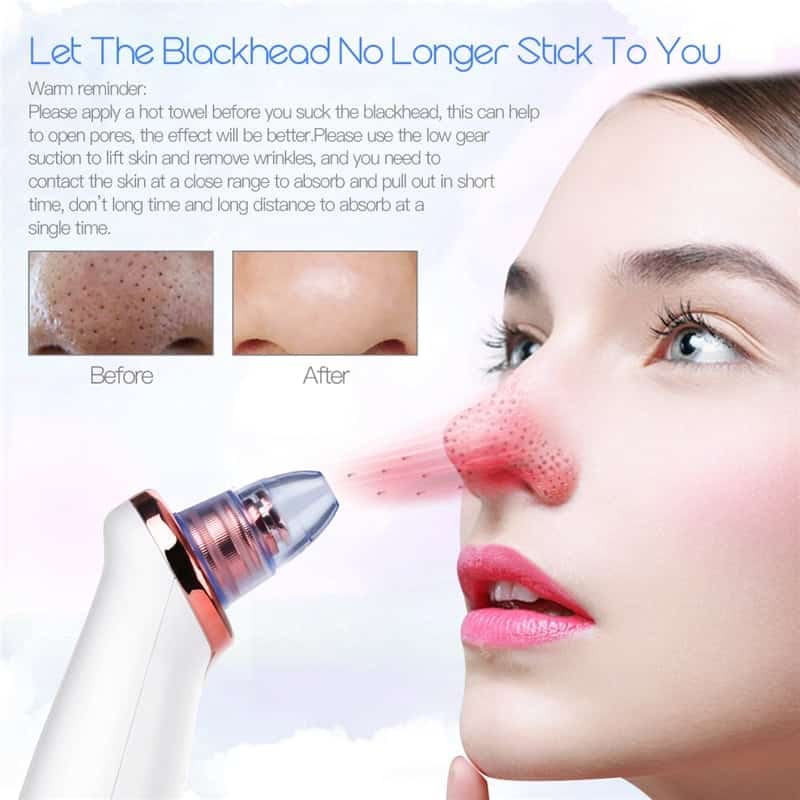 blackhead remover and facial pore vacuum cleanser 4